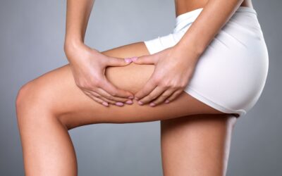 Ahora sí, chau celulitis